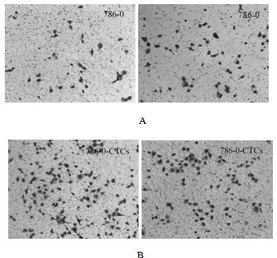 Isolation and culture method of mouse renal clear cell carcinoma circulating tumor cell line and human-derived clear cell renal carcinoma circulating tumor cell