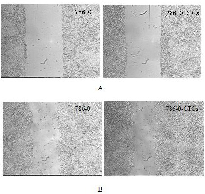 Isolation and culture method of mouse renal clear cell carcinoma circulating tumor cell line and human-derived clear cell renal carcinoma circulating tumor cell