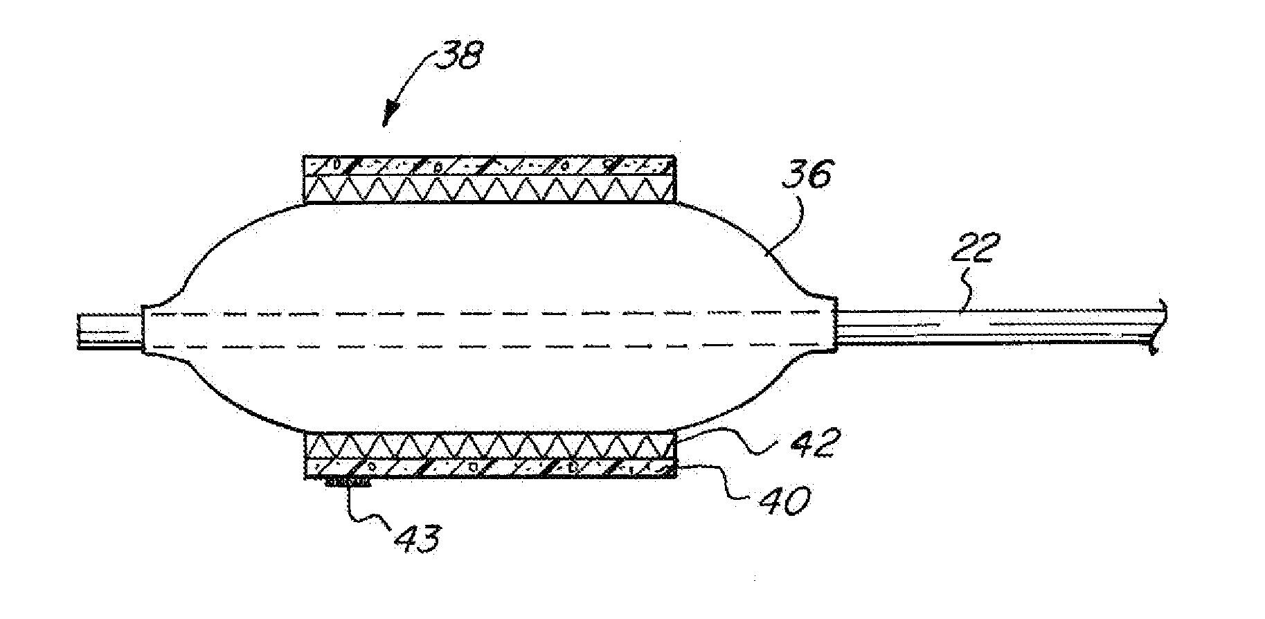 Balloon catheter for launching drug delivery device