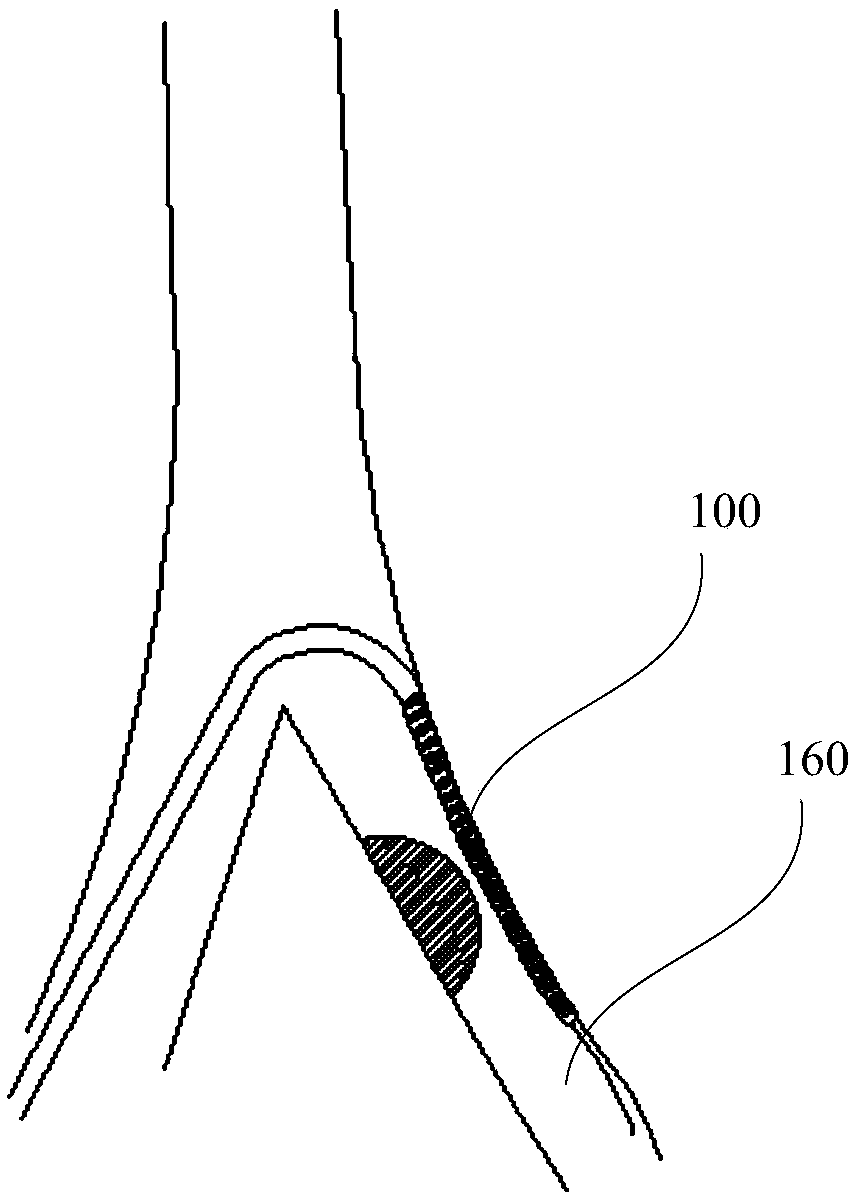 Covered stent and manufacturing method thereof