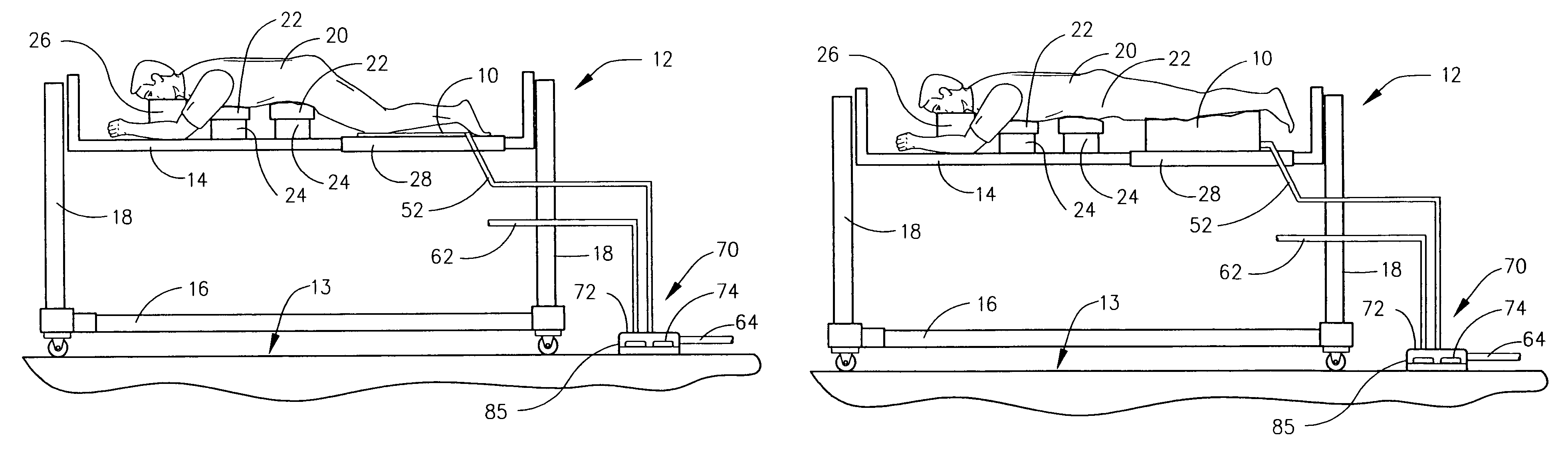 Inflatable cushion apparatus for use in surgical procedures and surgical method utilizing the same