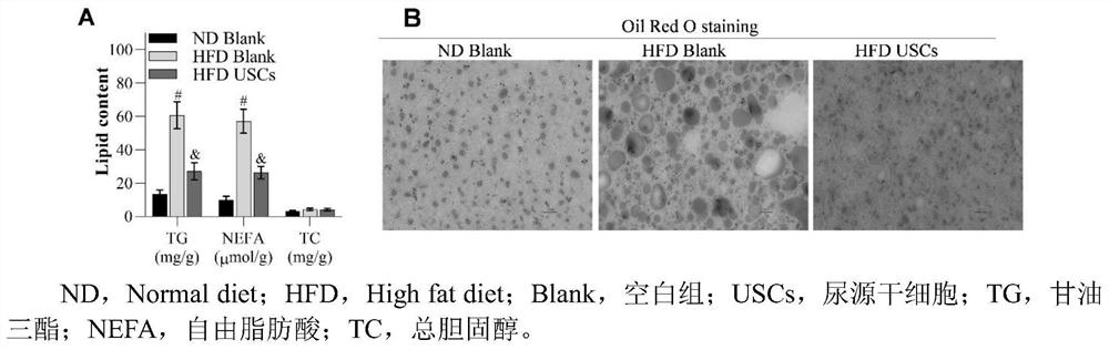 Application of urine-derived stem cells in preparation of biological preparation and medicine for treating non-alcoholic fatty liver disease, losing weight and lowering lipid