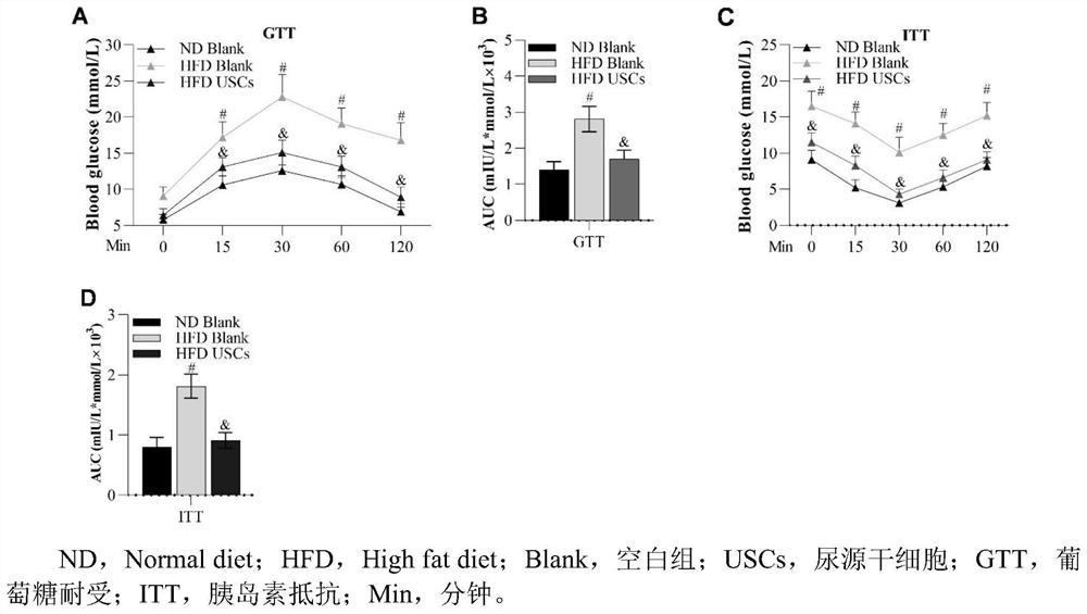 Application of urine-derived stem cells in preparation of biological preparation and medicine for treating non-alcoholic fatty liver disease, losing weight and lowering lipid