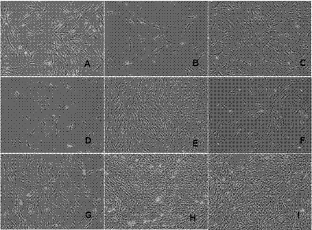 Medium without animal source components for cultivating human mesenchymal stem cells