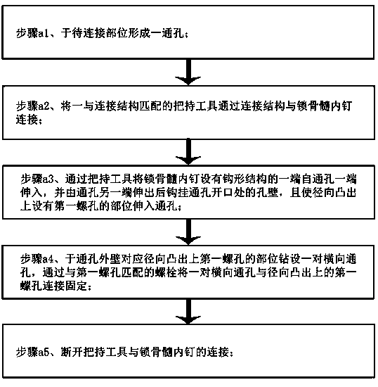 Clavicle intramedullary nail and method for using same