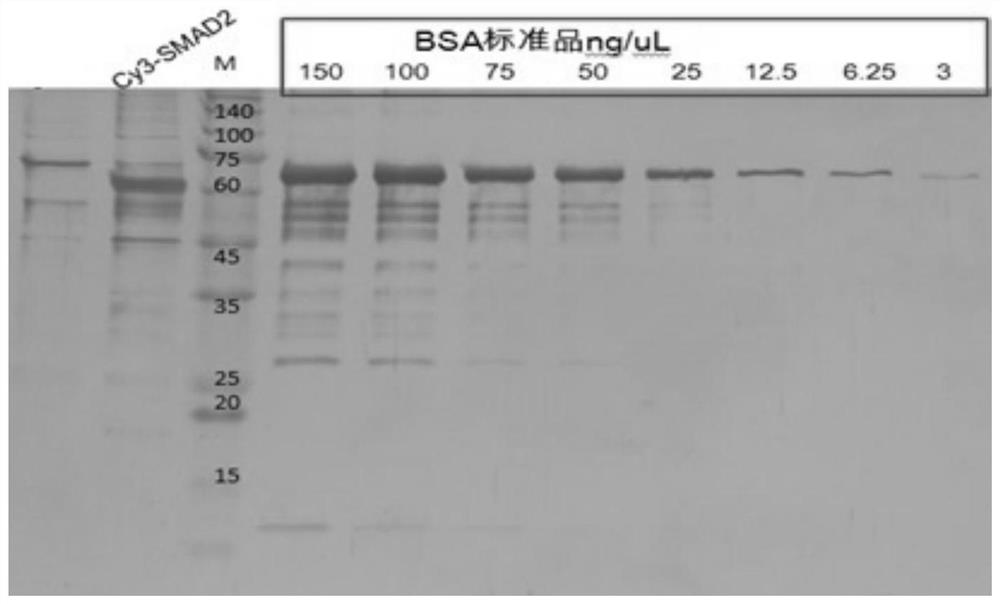 Tuberculosis protein interacting with human protein smad2 and its applications