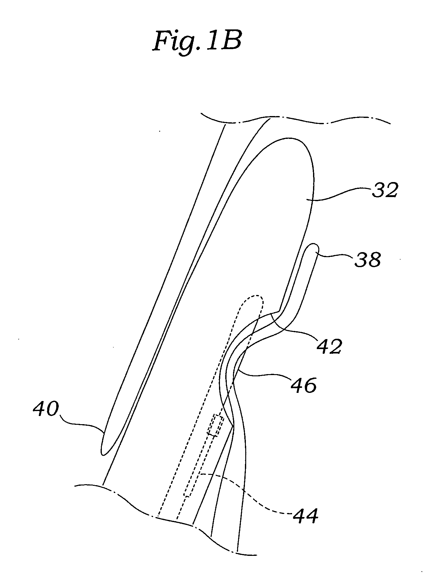 Expandable clip for tissue repair