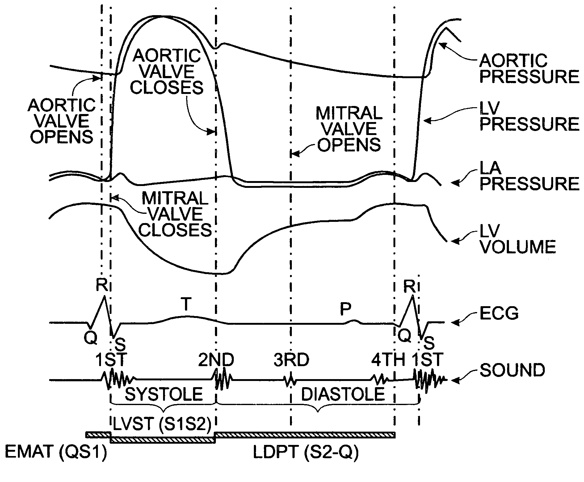 Rest phase heart pacing