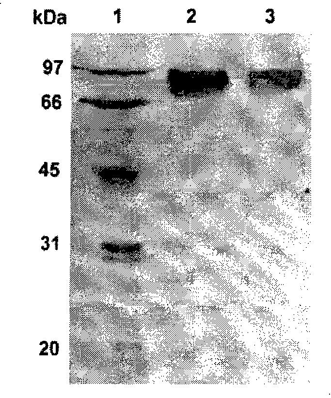 Acidic xylanase XYL10A and gene and application thereof