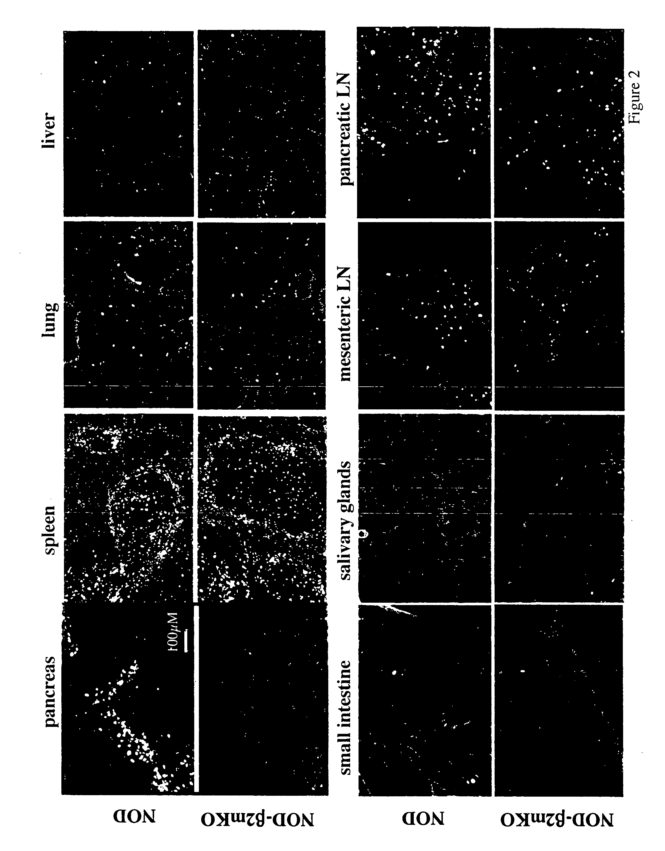 Methods of modulating homing of T cell by interruption of chemokine/chemokine receptor signaling