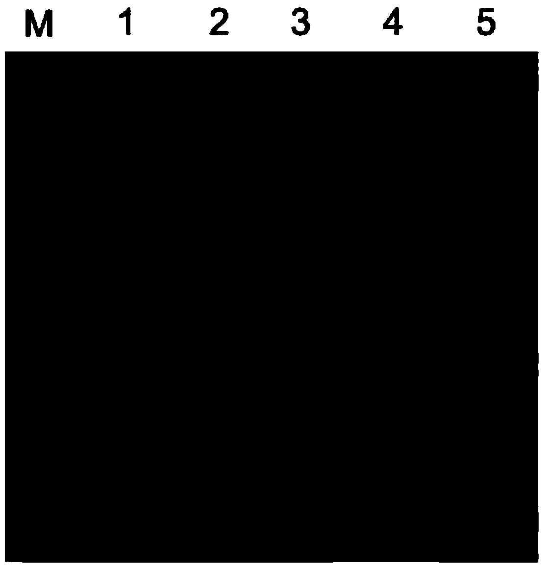 Preparation method of human neutrophil gelatinase associated lipocalin (NGAL)