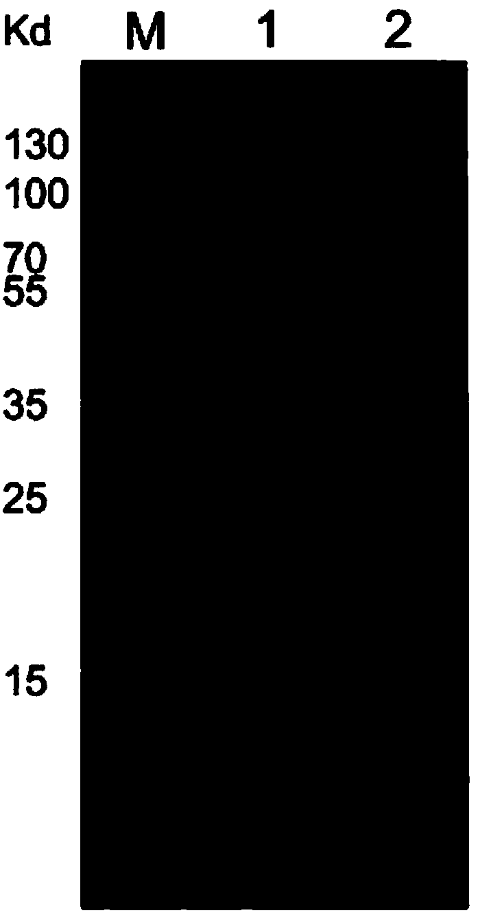 Preparation method of human neutrophil gelatinase associated lipocalin (NGAL)