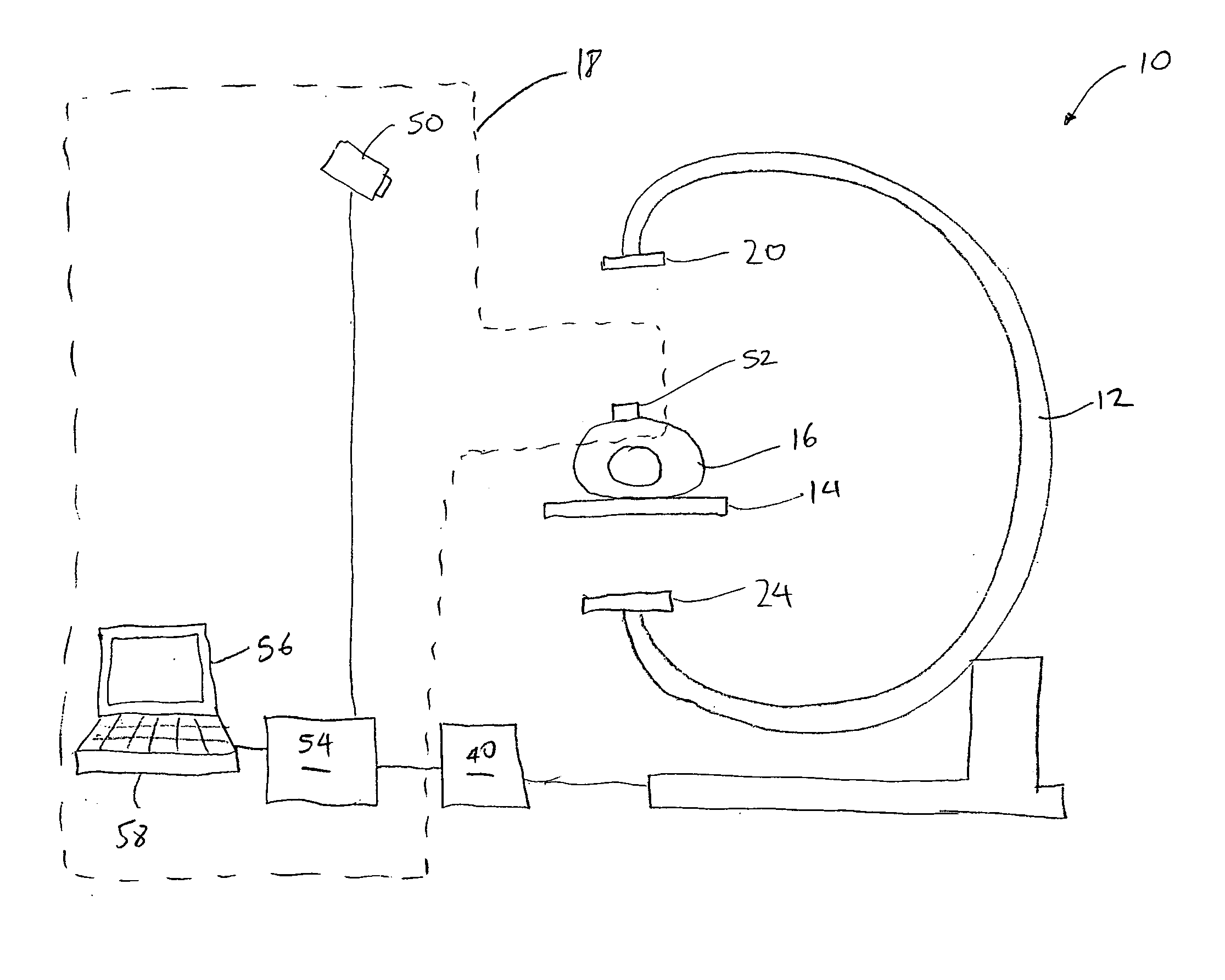 Breathing synchronized computed tomography image acquisition