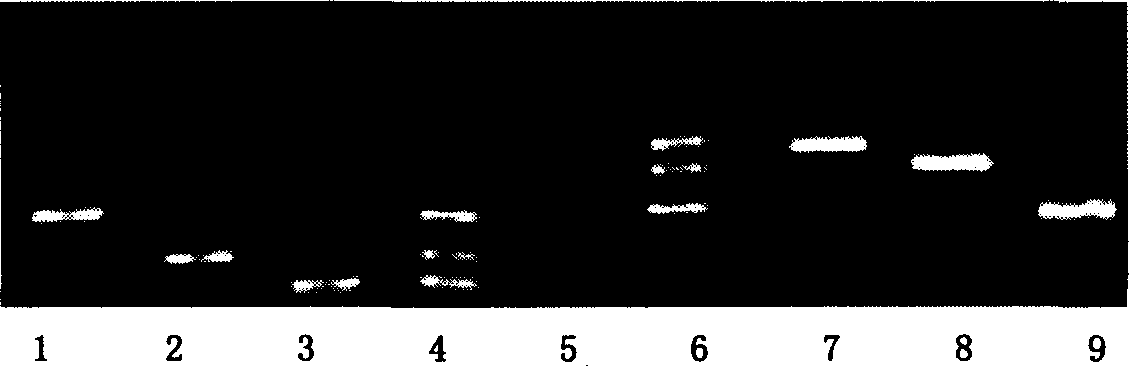 A set of oligonucleotide probe for detecting intestinal hemorrhage type colibacillus and vibrio cholerae