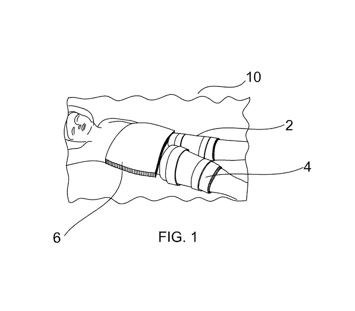 Non-invasive thermal wrap method for inducing calorie burning and weight loss
