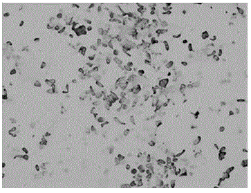 Early gastric adenocarcinoma primary cells single-stranded DNA aptamer and preparation method thereof