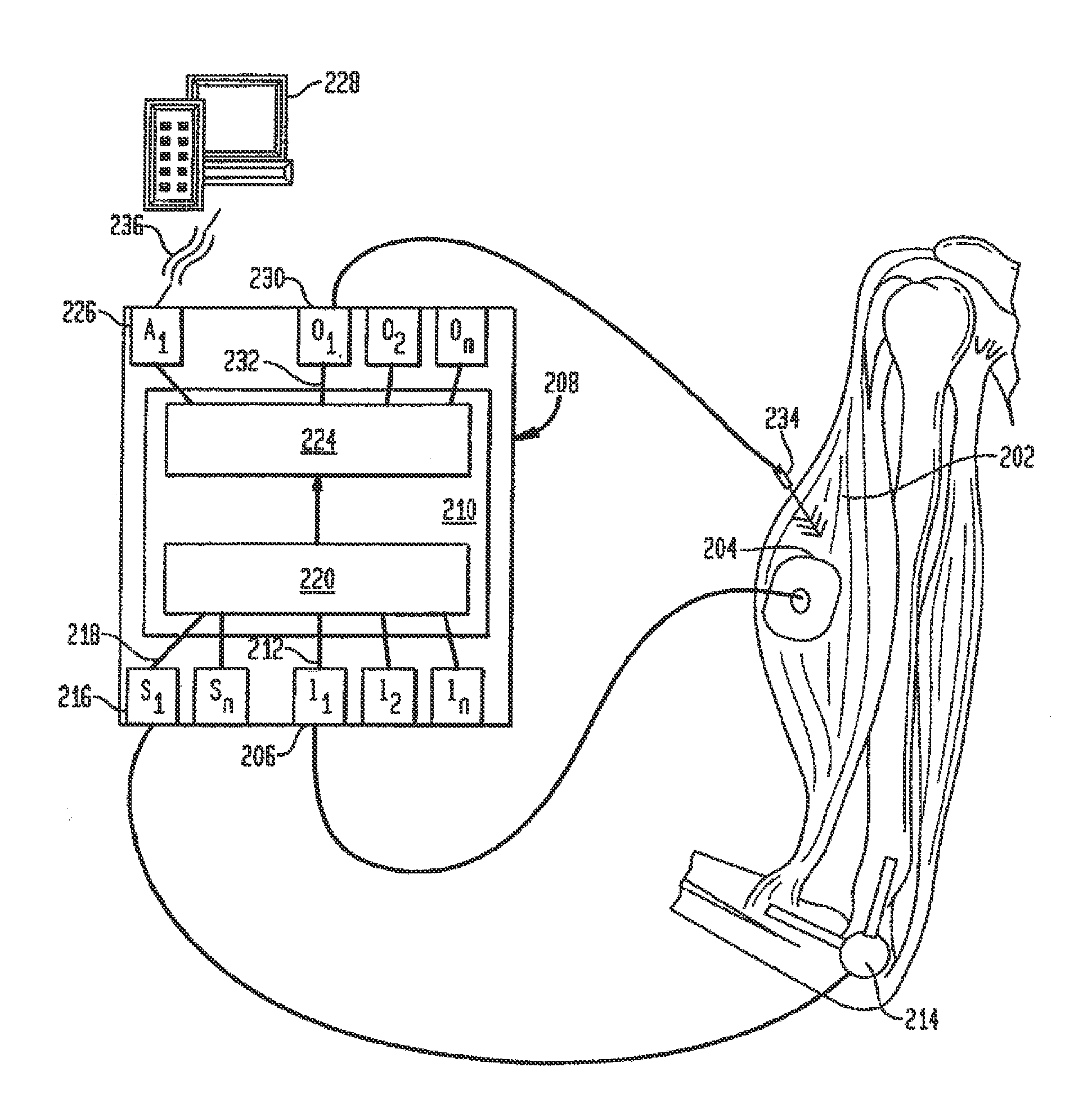 Neural prosthesis system and method of control