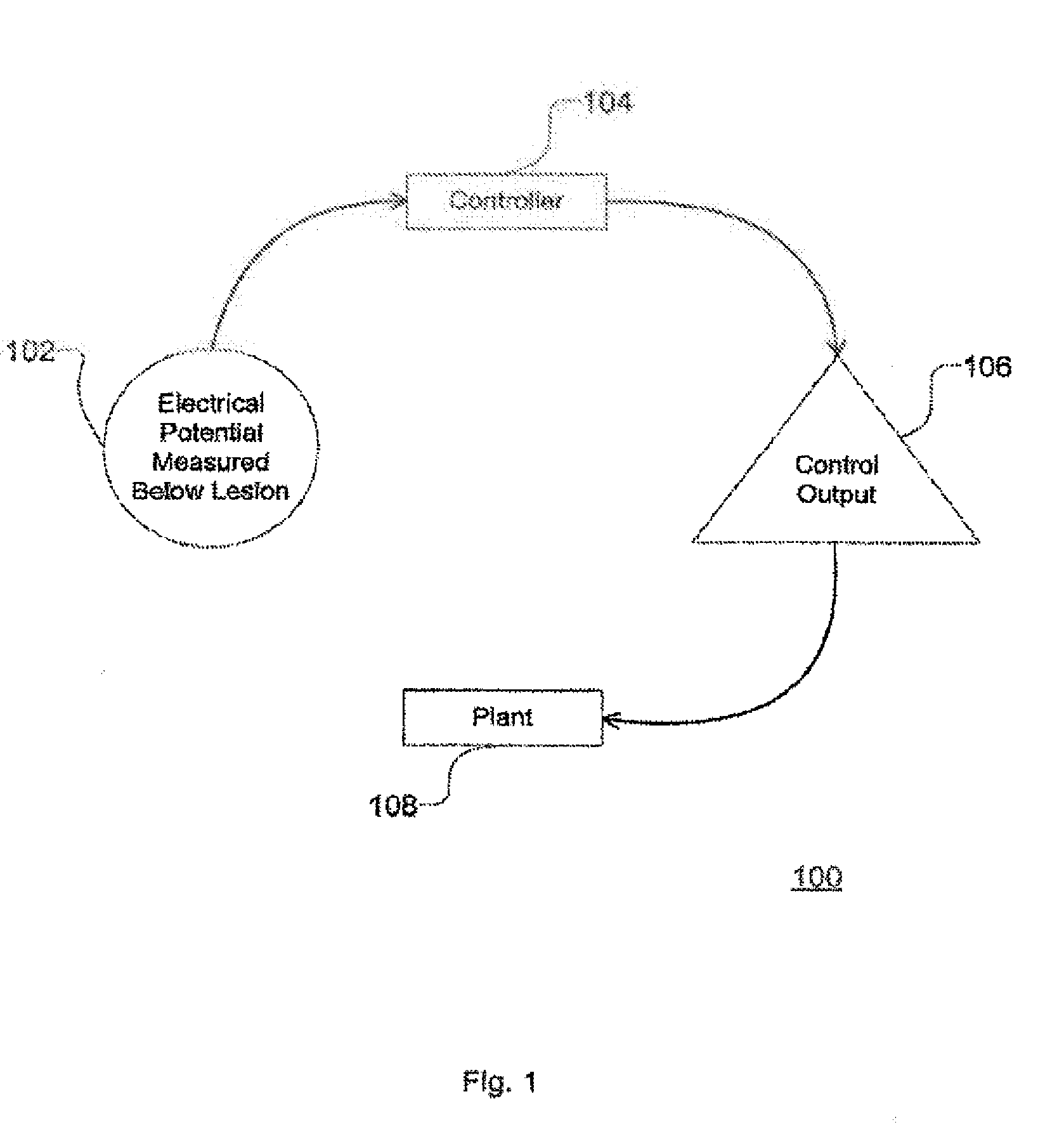 Neural prosthesis system and method of control