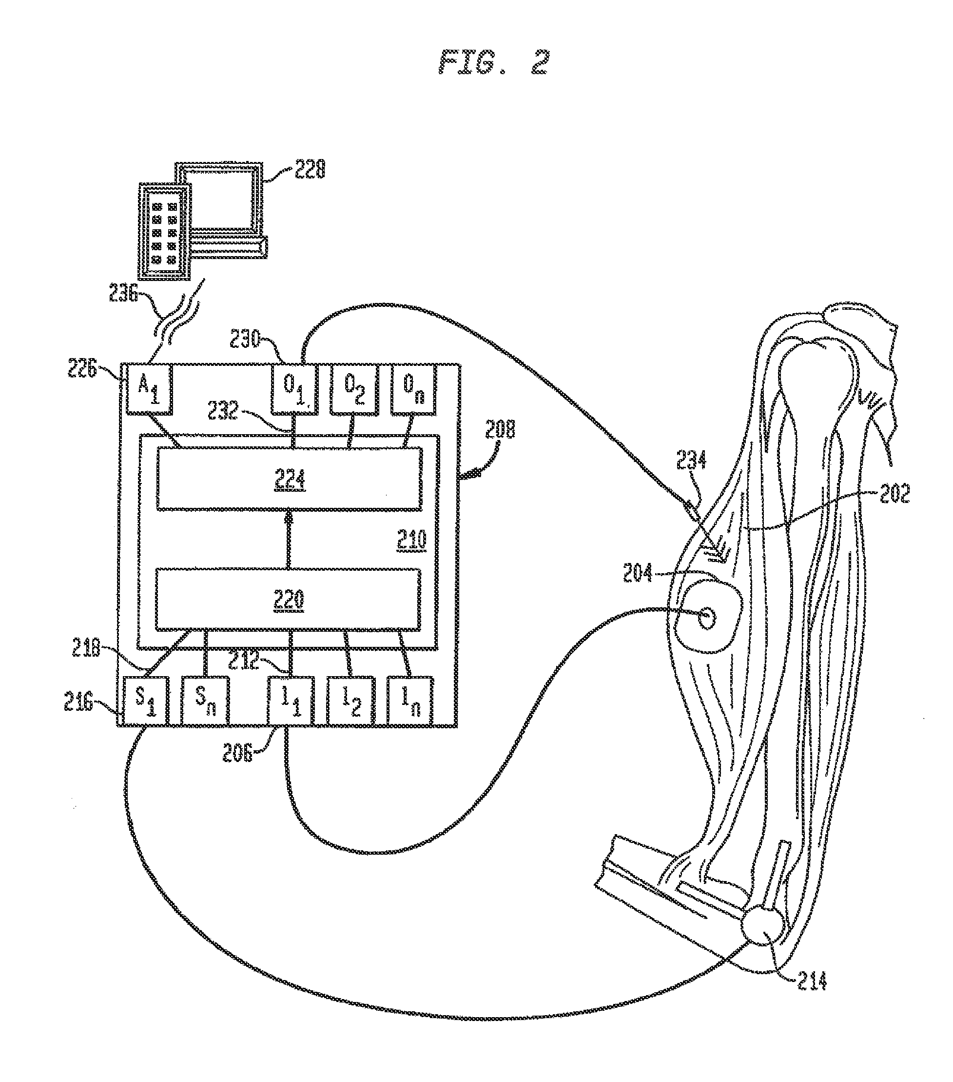 Neural prosthesis system and method of control