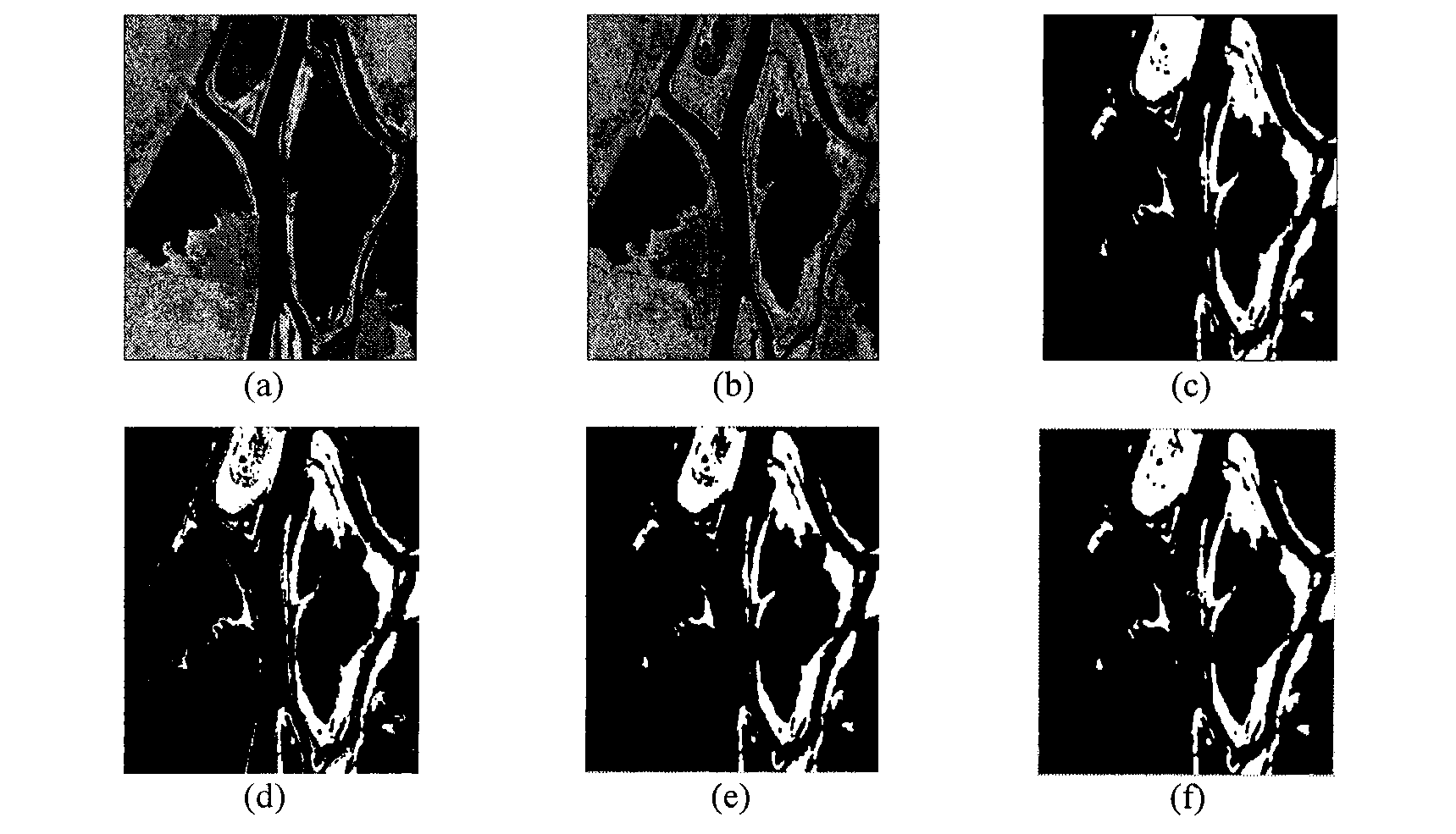 SAR (synthetic aperture radar) image change detection method combining multi-threshold segmentation with fuzzy clustering