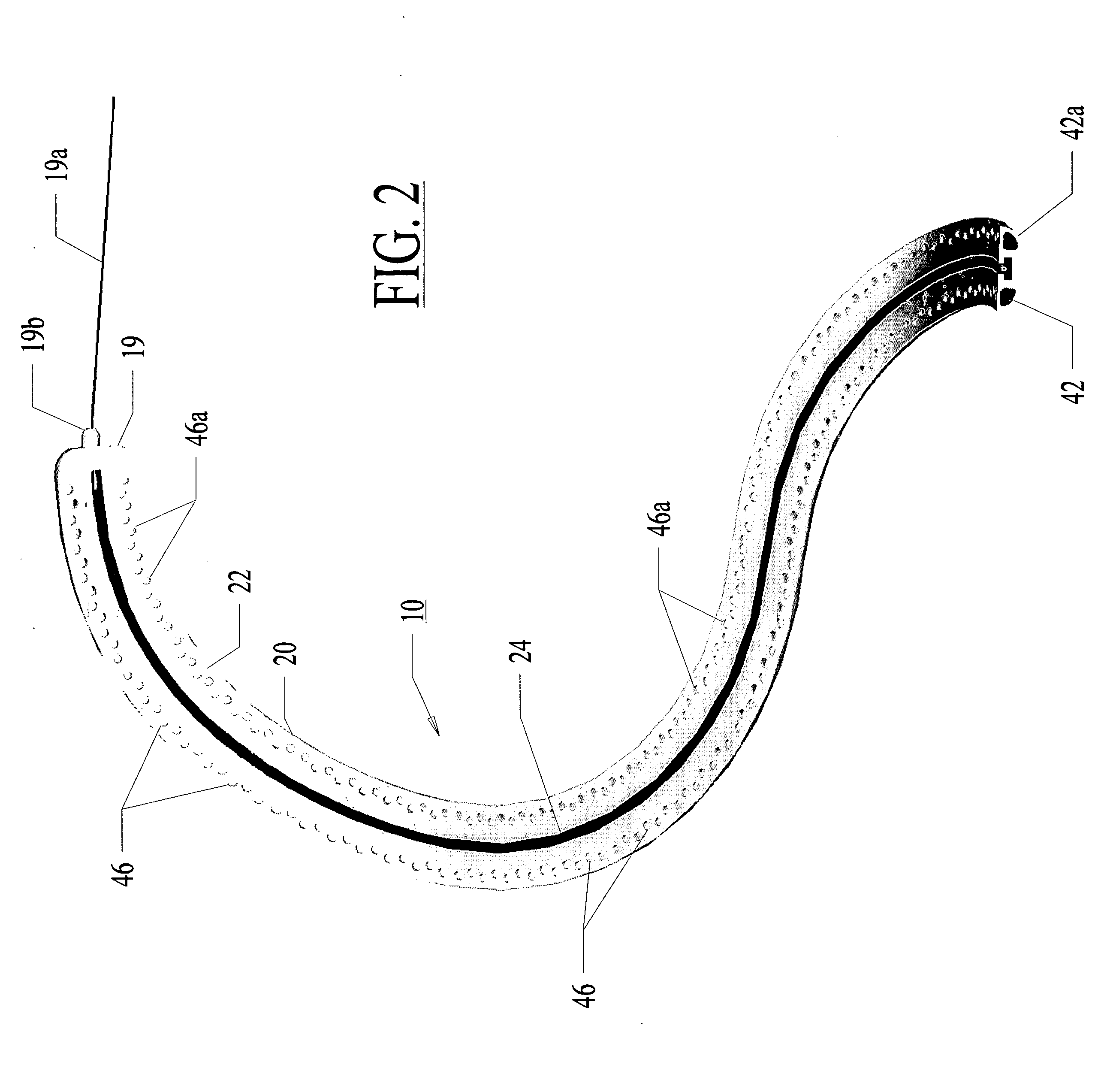 Apparatus and method for guided ablation treatment