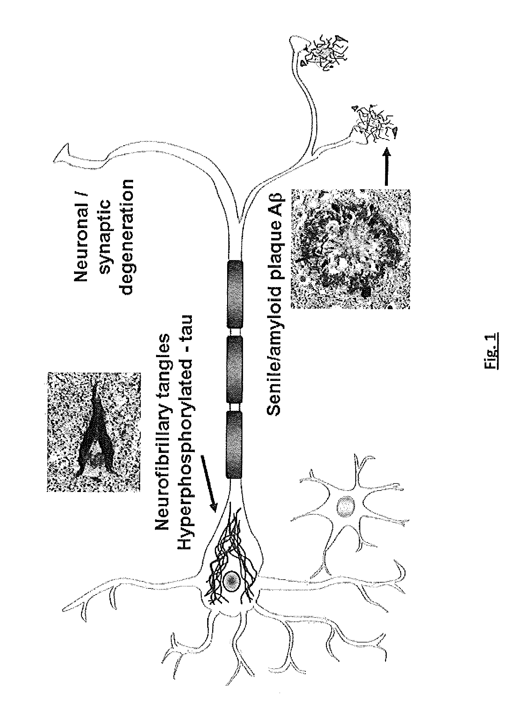 Effective Amounts of (3aR)-1,3a,8-Trimethyl-1,2,3,3a,8,8a-hexahydropyrrolo [2,3-b]indol-5-yl Phenylcarbamate and Methods of Treating or Preventing Neurodegeneration
