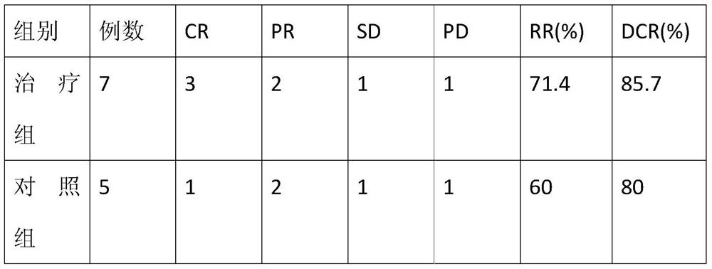 Application of Aidi preparation in preparation of anti-malignant pleural mesothelioma medicine