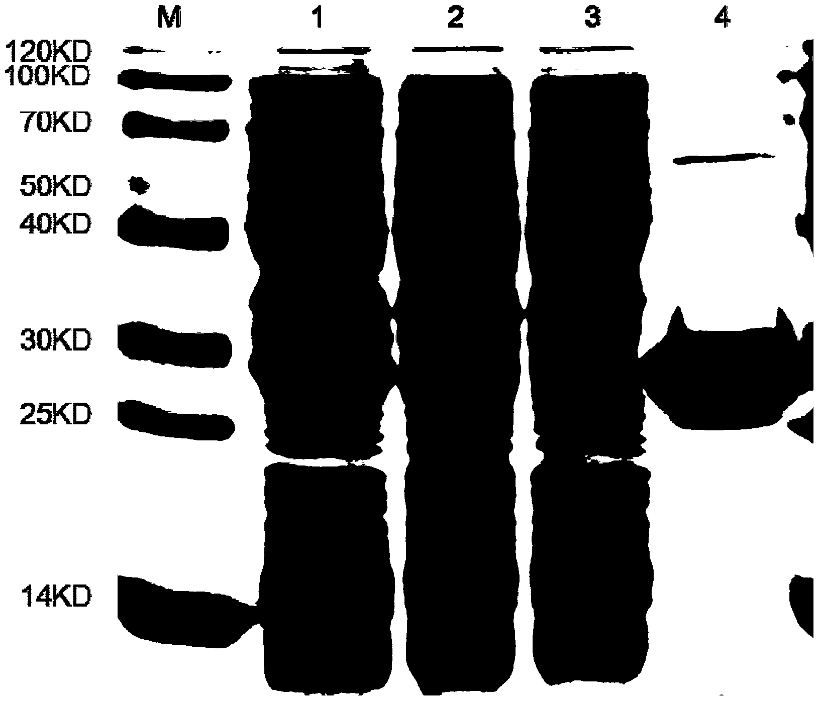 Enzymatic antibiotic for killing gram-positive bacteria and preparation and use of enzymatic antibiotic