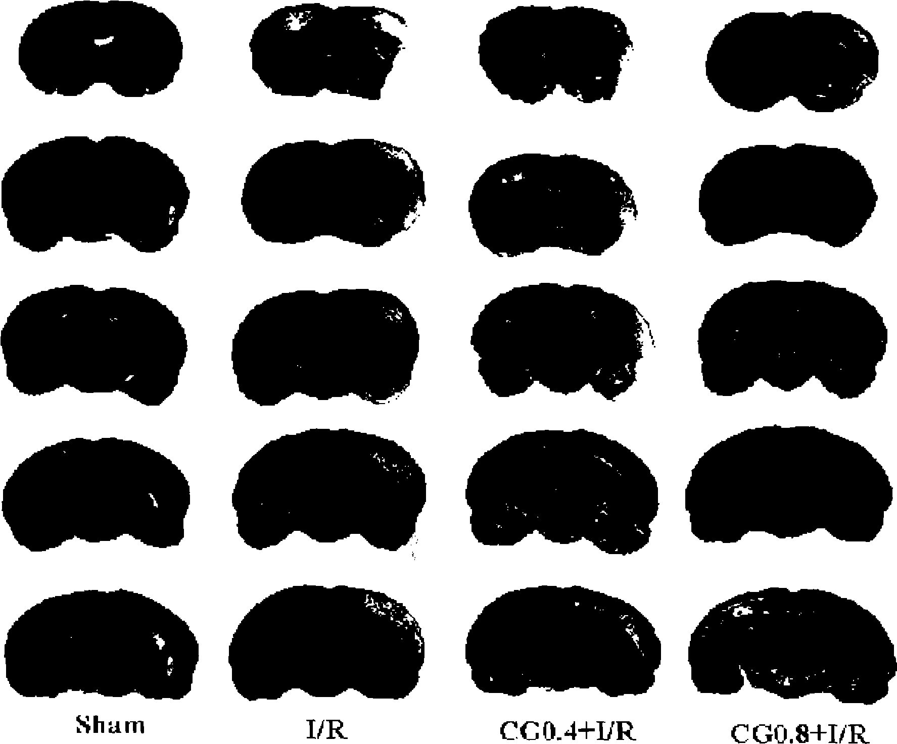 Prevention effect of blood-nourishing and brain-refreshing granules on trauma of cerebral nerve cell