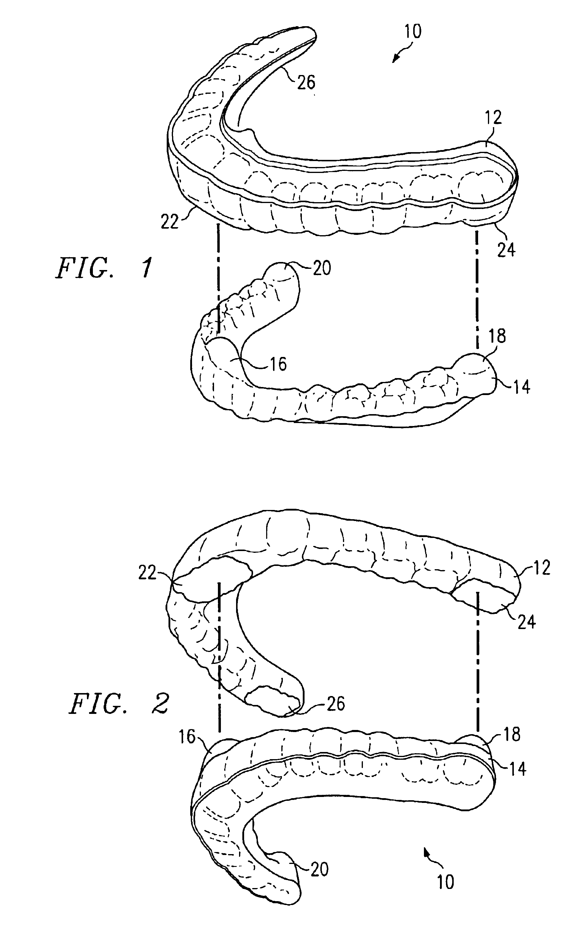 Oral appliance for maintaining stability of one or more aspects of a user's masticatory system