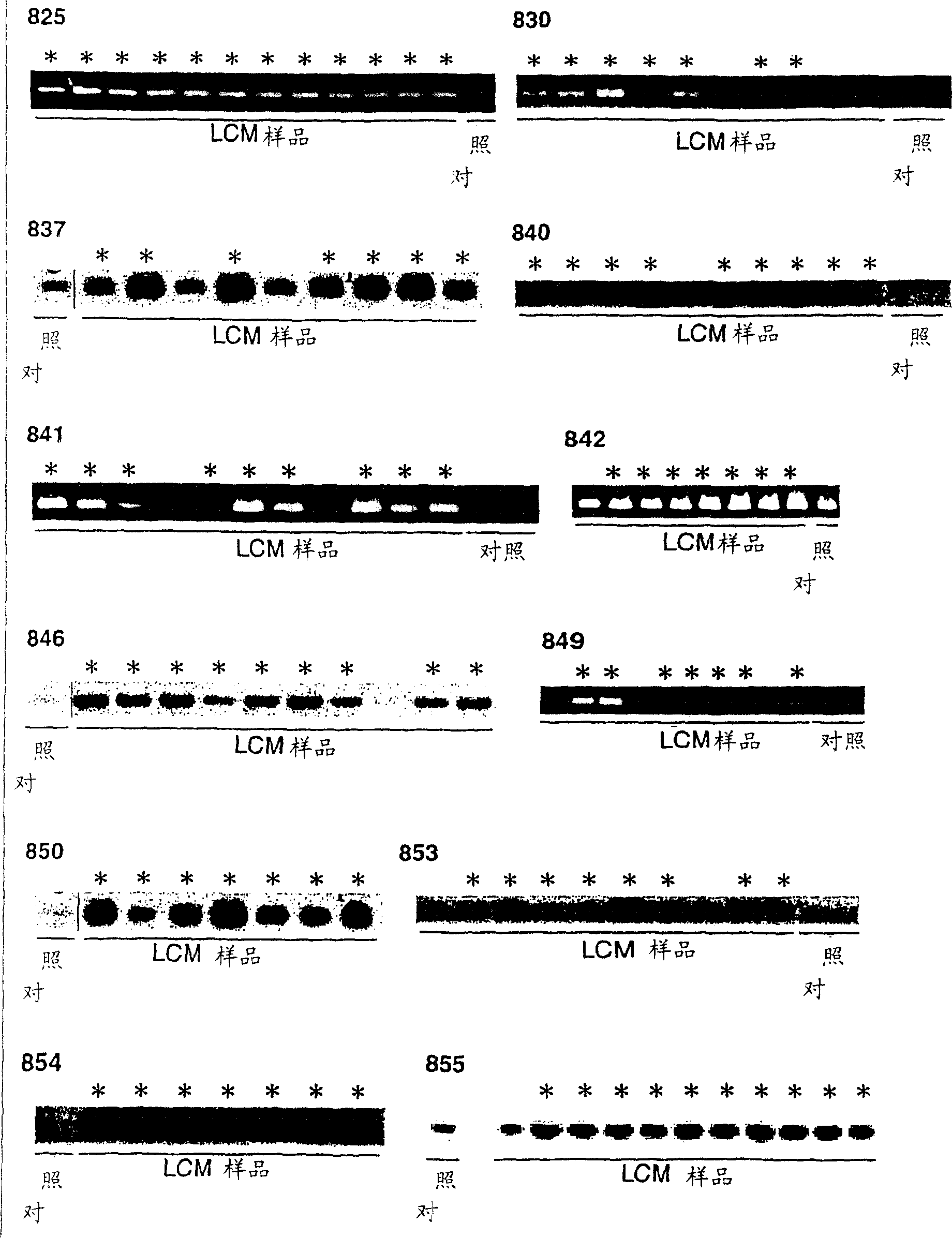 Method for diagnosing non-small cell lung cancers