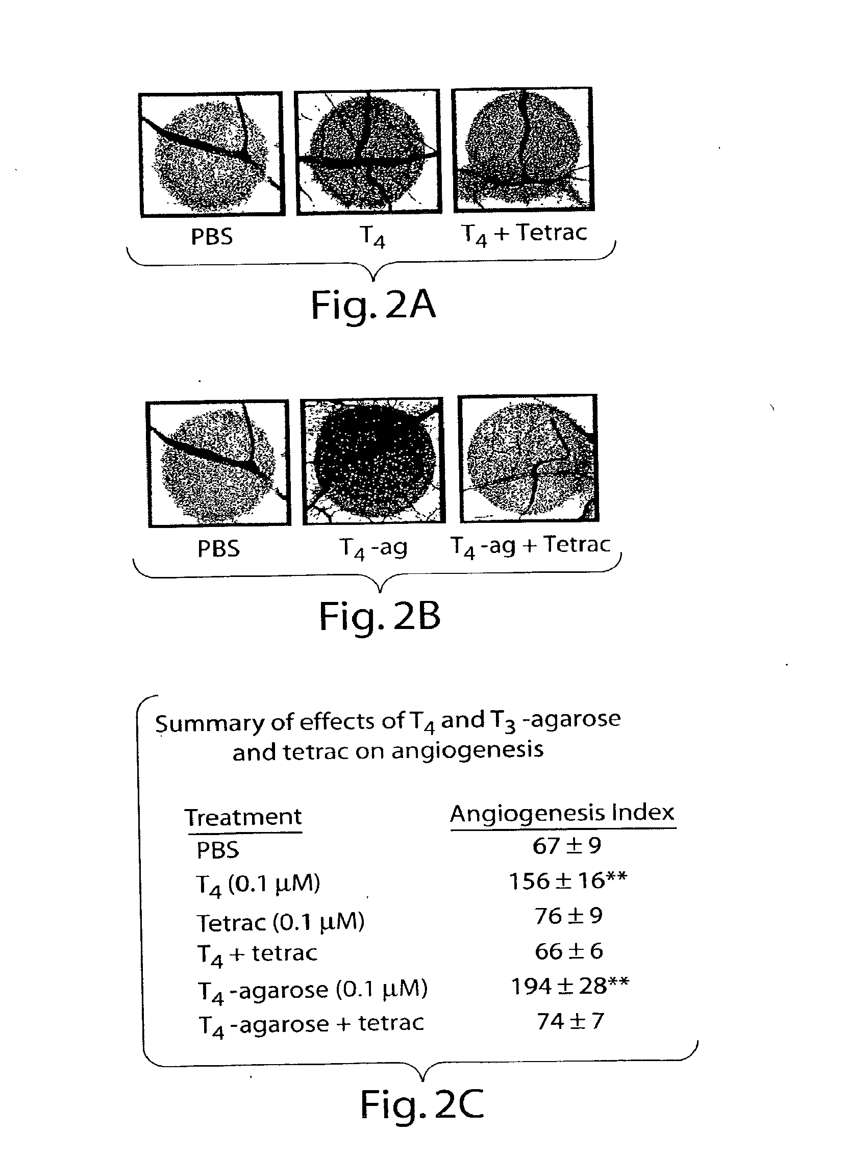 Thyroid hormone analogs and methods of use