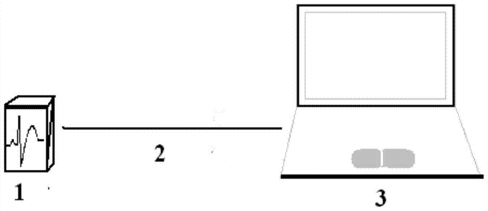 Method and system for analyzing electrocardiogram data