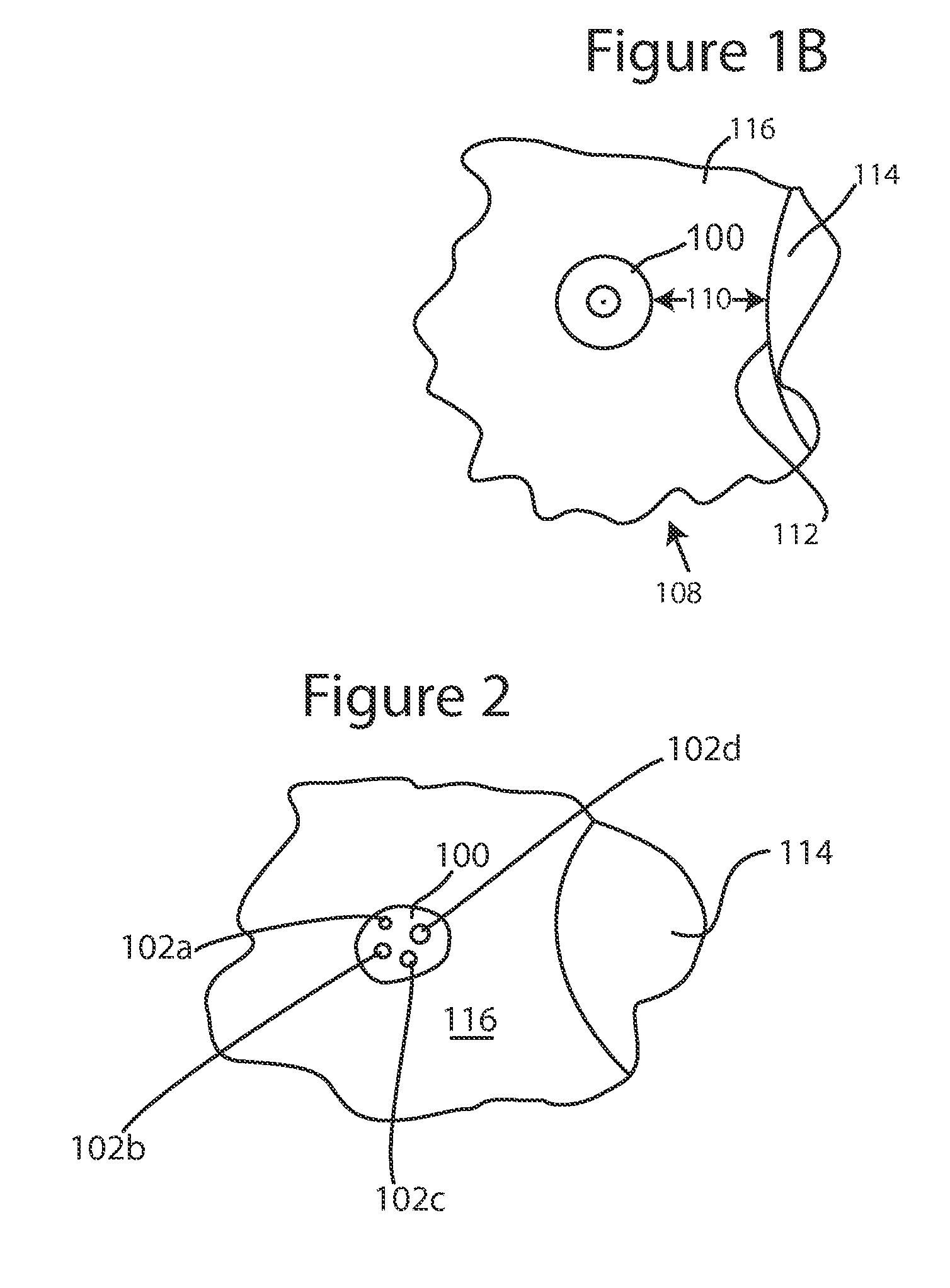 Glaucoma drainage device and uses thereof