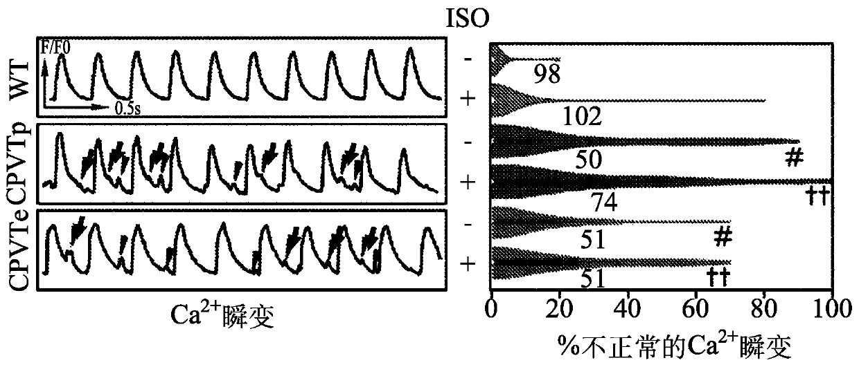 Compositions and methods for treating or preventing catecholaminergic polymorphic ventricular tachycardia