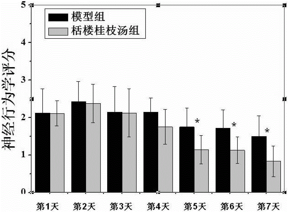 Application of Tianlou Guizhi decoction in treatment of post-stroke spasm
