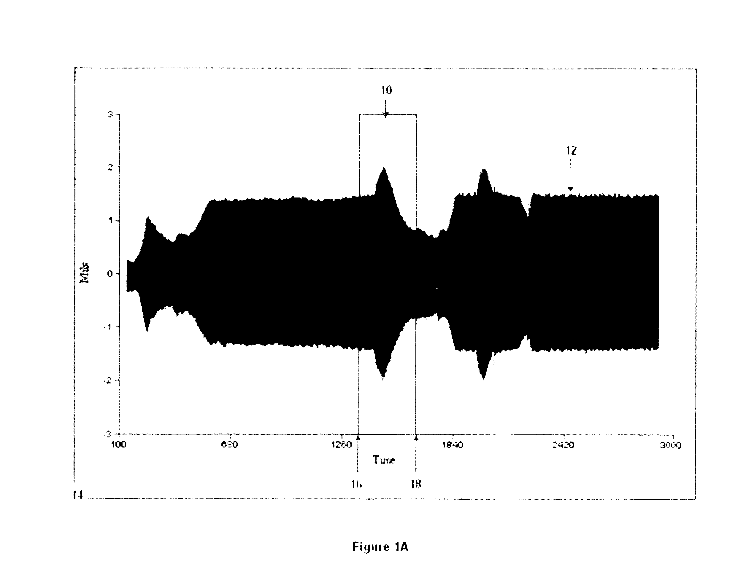 Method and apparatus for identifying a region of interest of transient vibration data requiring analysis