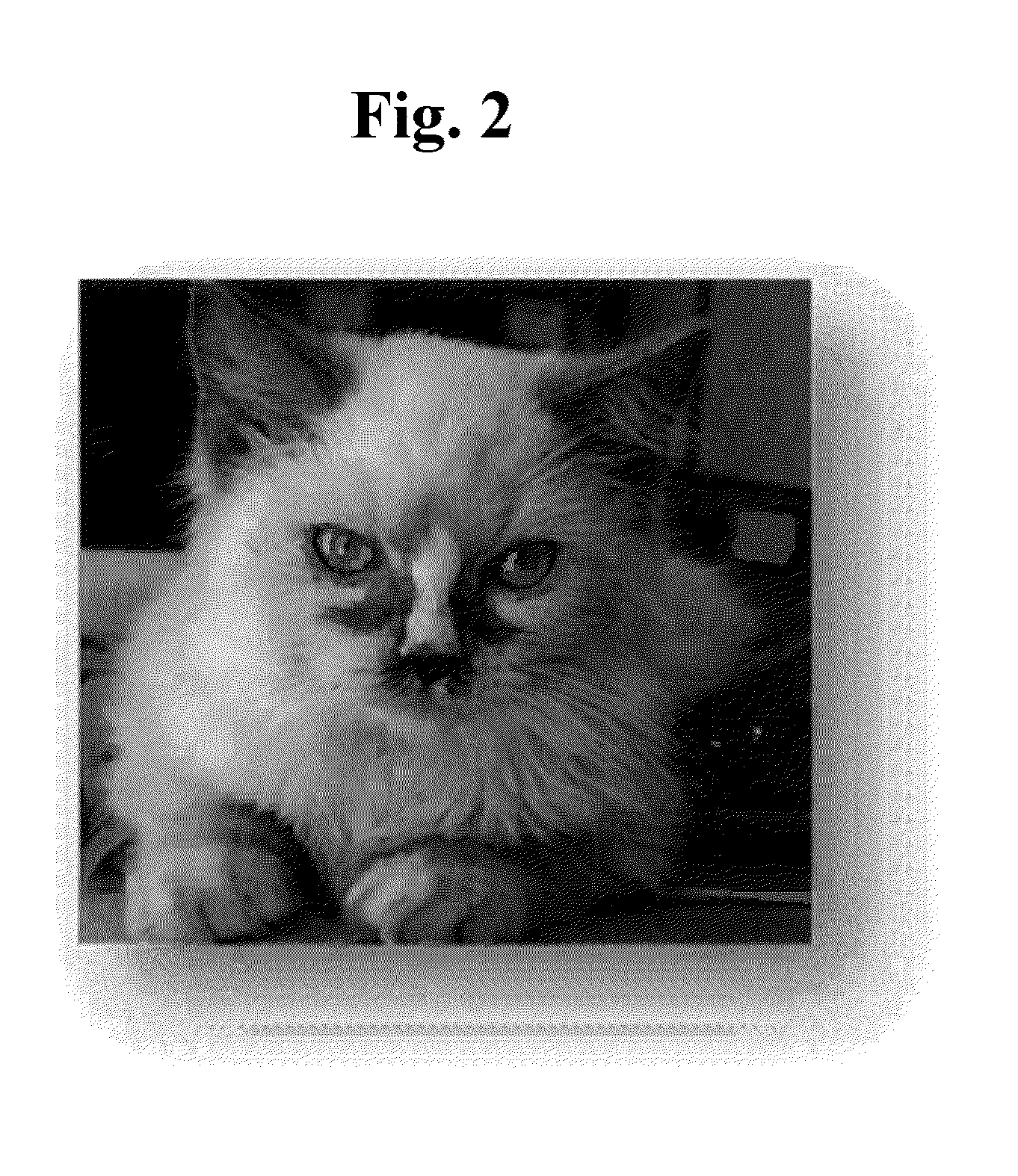 Compositions, methods, and devices for the treatment of eye stain