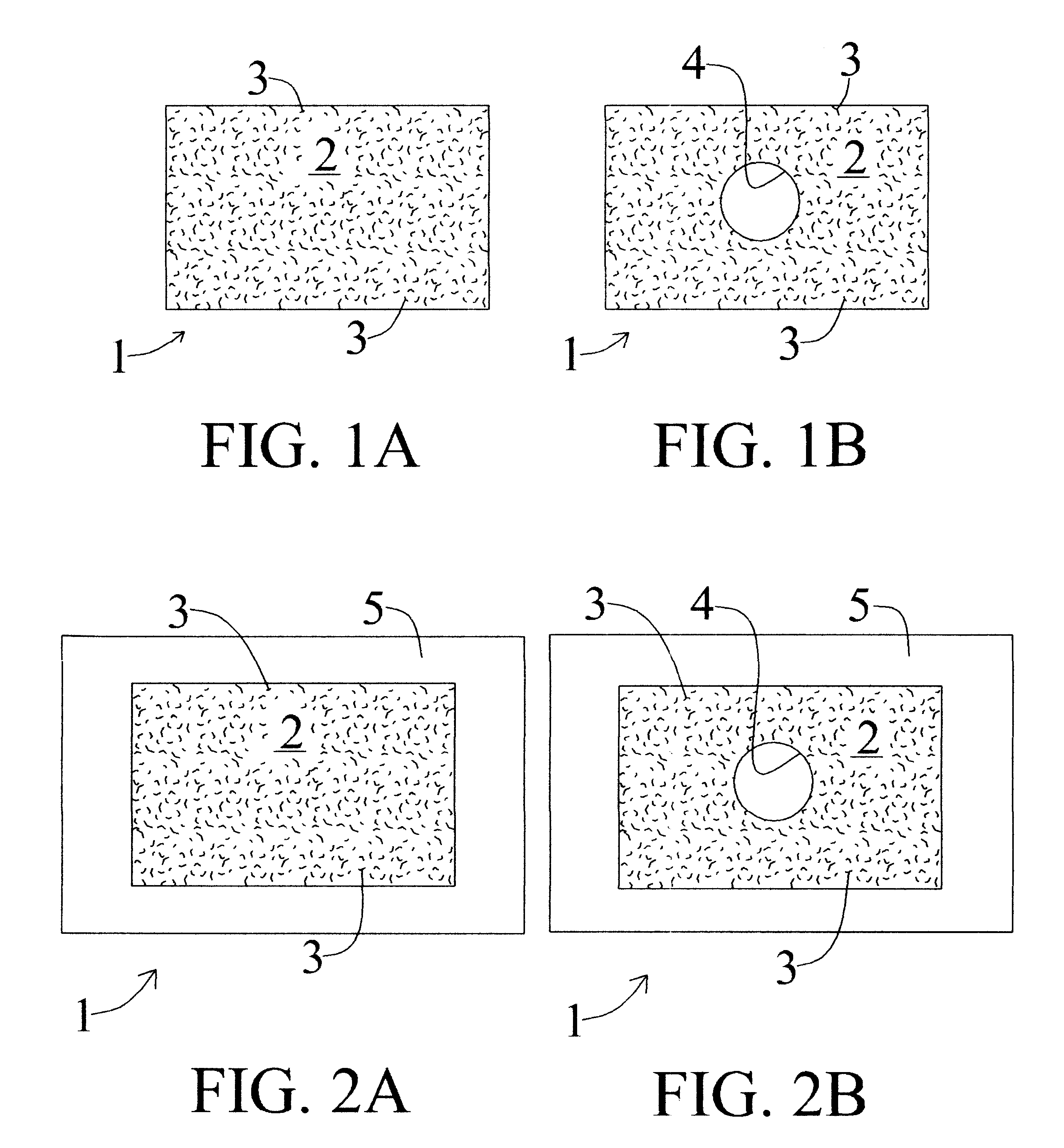 Apparatus and methods for preventing or treating failure of hemodialysis vascular access and other vascular grafts