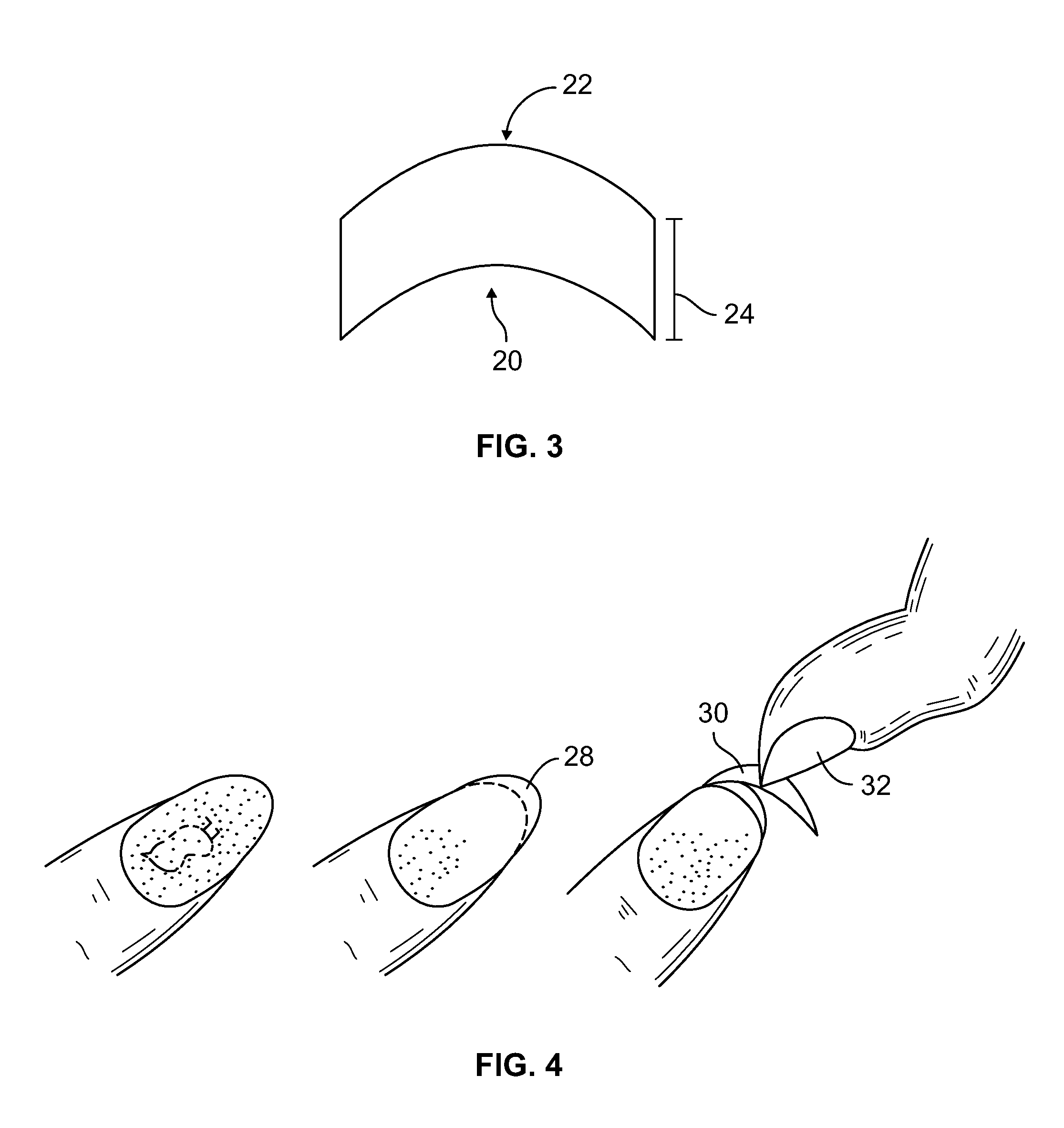 Method and product for attaining a french manicure using a dry nail applique