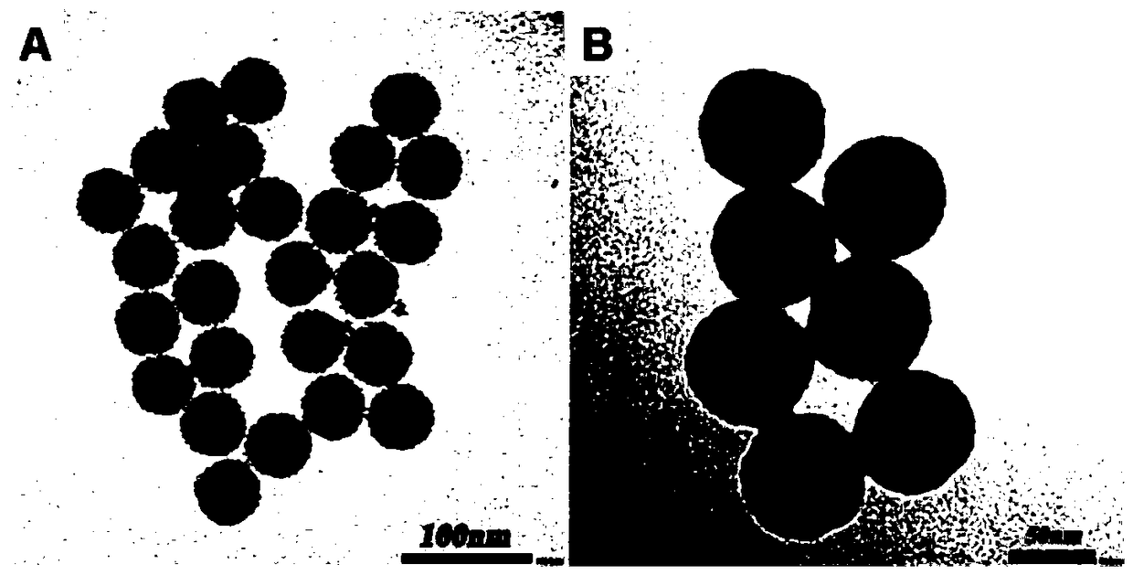 A sound-controlled nanoparticle-loaded berberine release system and its preparation method and application