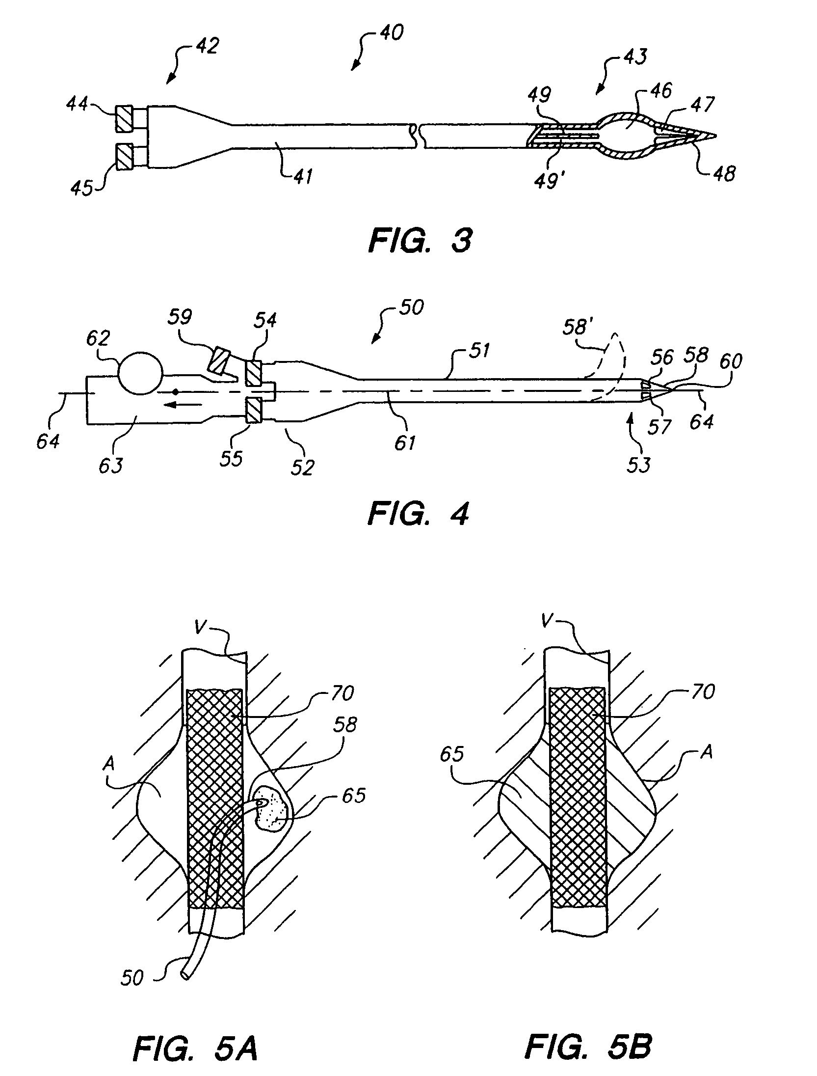 Methods and apparatus for intraluminal deposition of hydrogels
