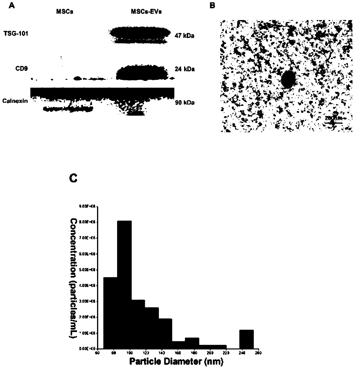 Application of extracellular vesicles derived from mesenchymal stem cells in the treatment of subarachnoid hemorrhage