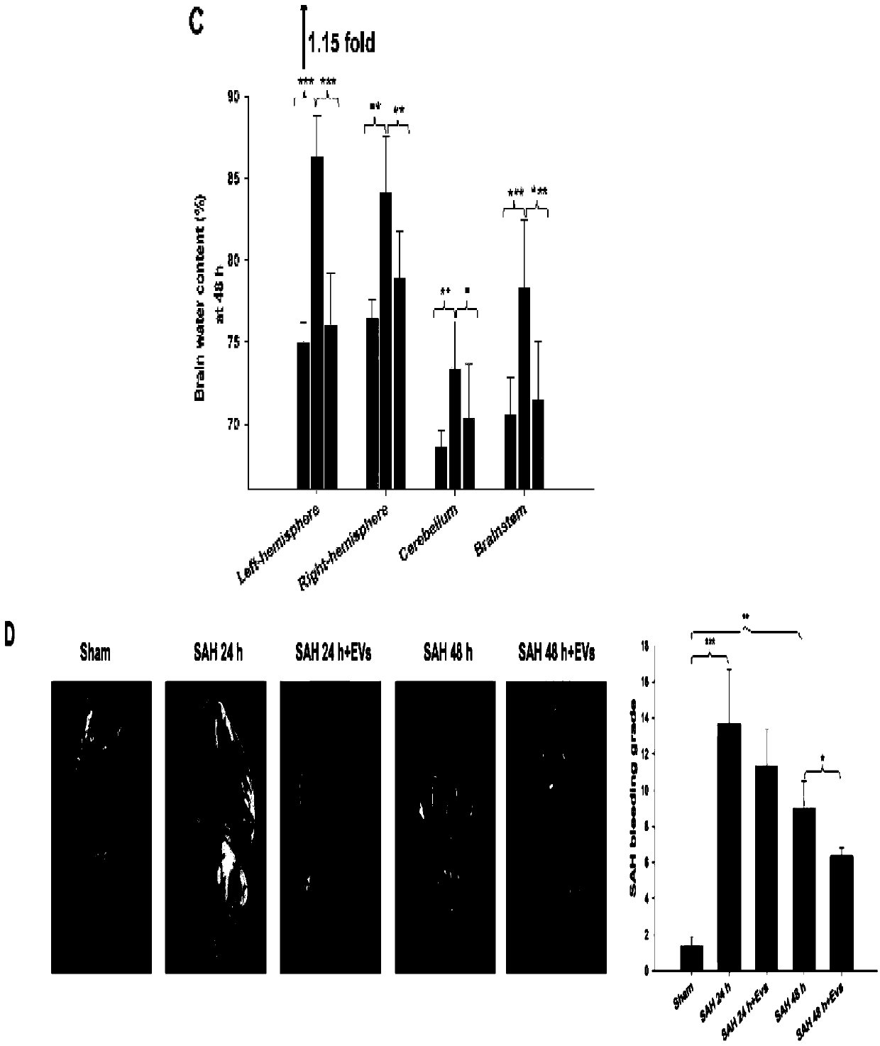 Application of extracellular vesicles derived from mesenchymal stem cells in the treatment of subarachnoid hemorrhage