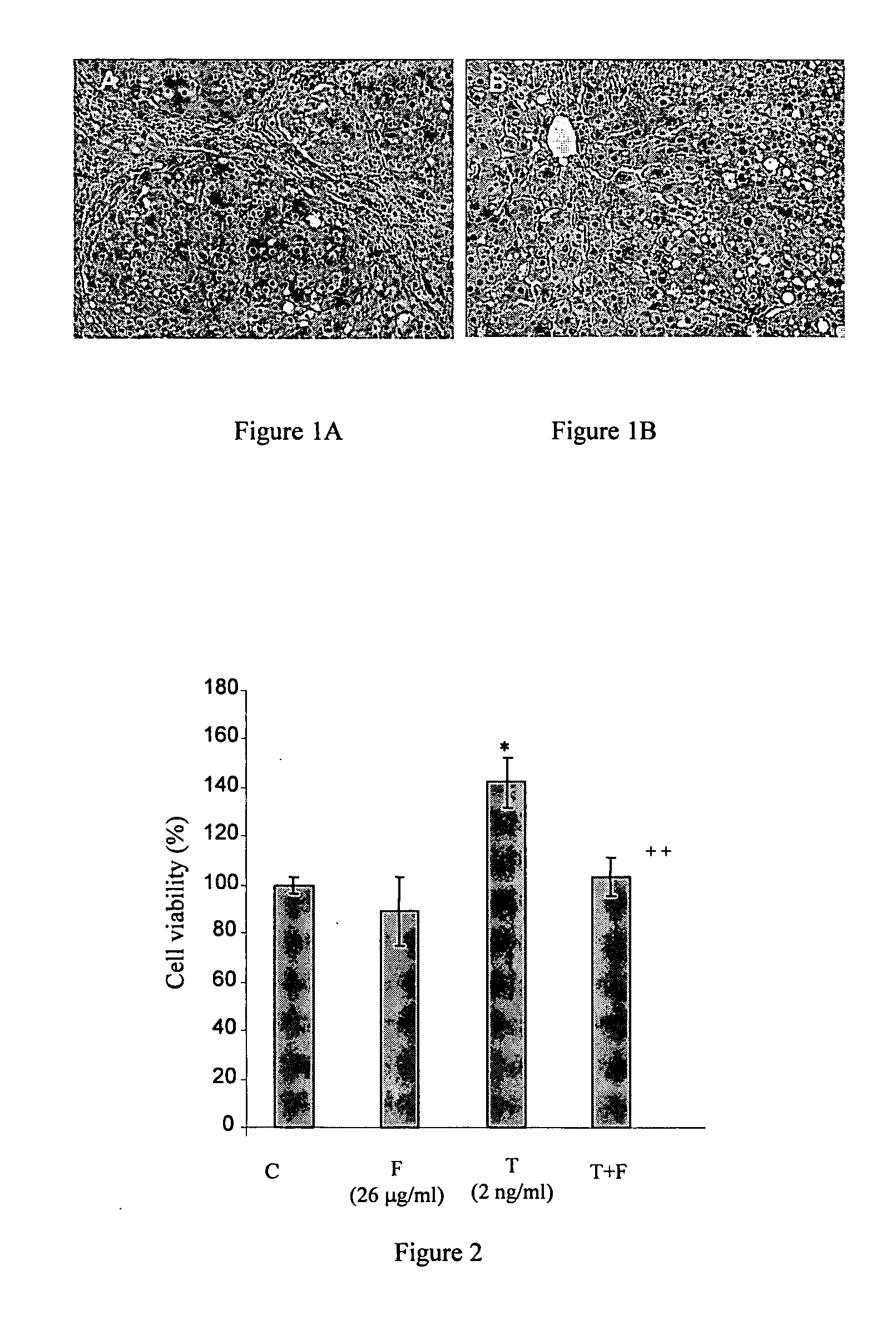 Method for inhibiting fibrogenesis by a mixture of natural peptides from porcine liver extract