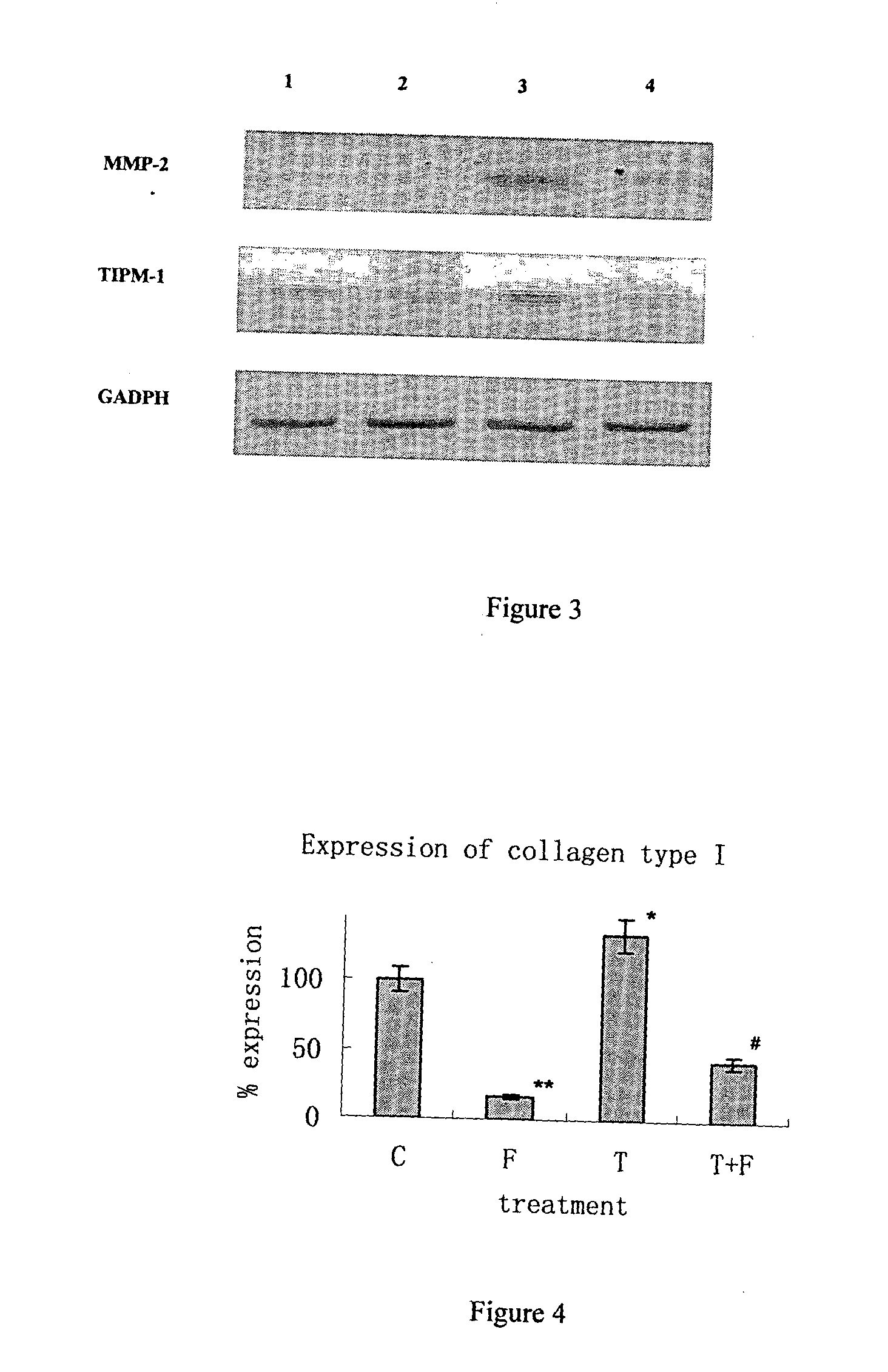 Method for inhibiting fibrogenesis by a mixture of natural peptides from porcine liver extract