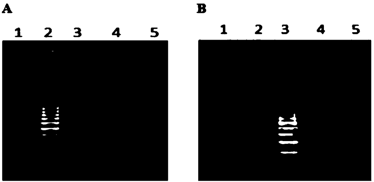 Typing detection method for applying loop-mediated isothermal nucleic acid amplification technology to alveolar echinococcus/echinococcus granulosus and detection kit