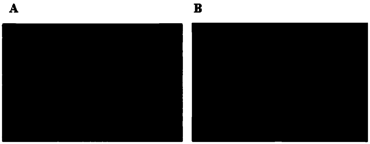 Typing detection method for applying loop-mediated isothermal nucleic acid amplification technology to alveolar echinococcus/echinococcus granulosus and detection kit