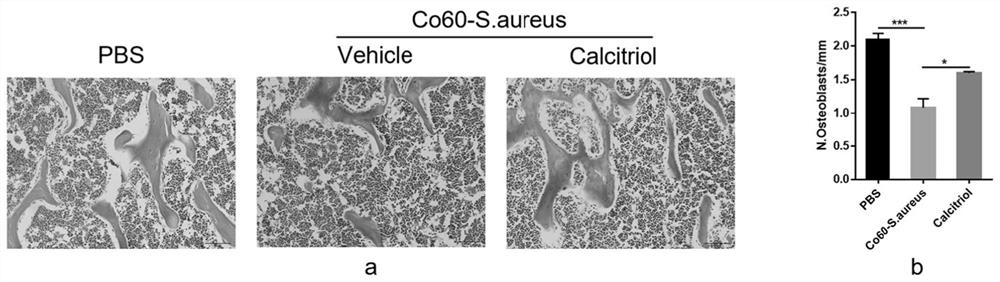 Application of vitamin D receptor stimulant in preparation of medicine for preventing and/or treating inflammatory bone loss