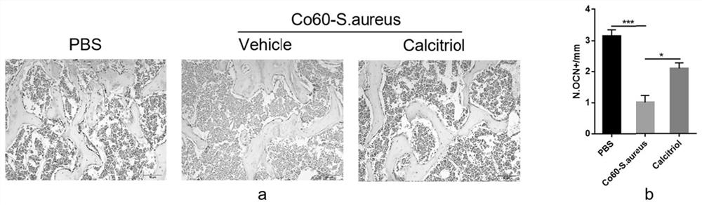 Application of vitamin D receptor stimulant in preparation of medicine for preventing and/or treating inflammatory bone loss